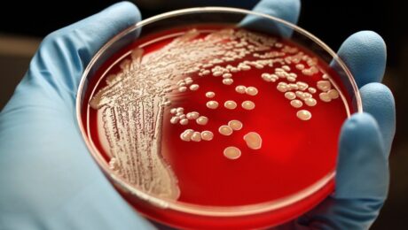 bactérias nocivas